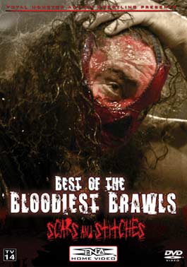 Best of the Bloodiest Brawls (Scars and Stiches)